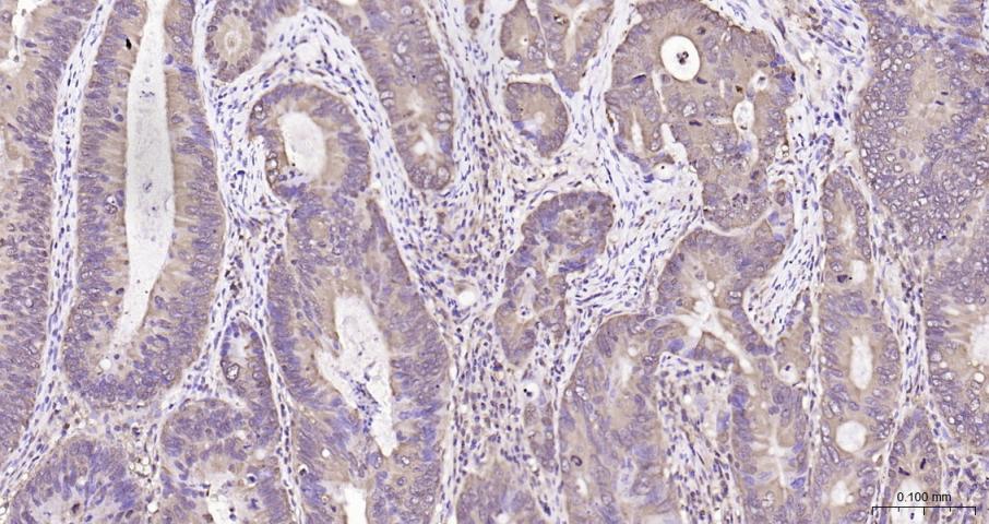 乳酸脱氢酶重组兔单抗