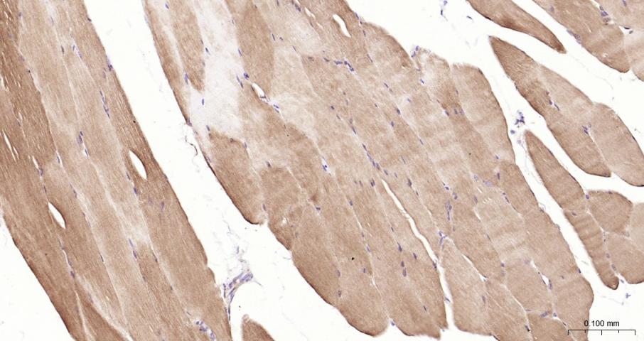 乳酸脱氢酶重组兔单抗