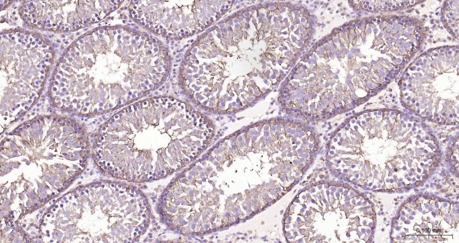 乳酸脱氢酶重组兔单抗