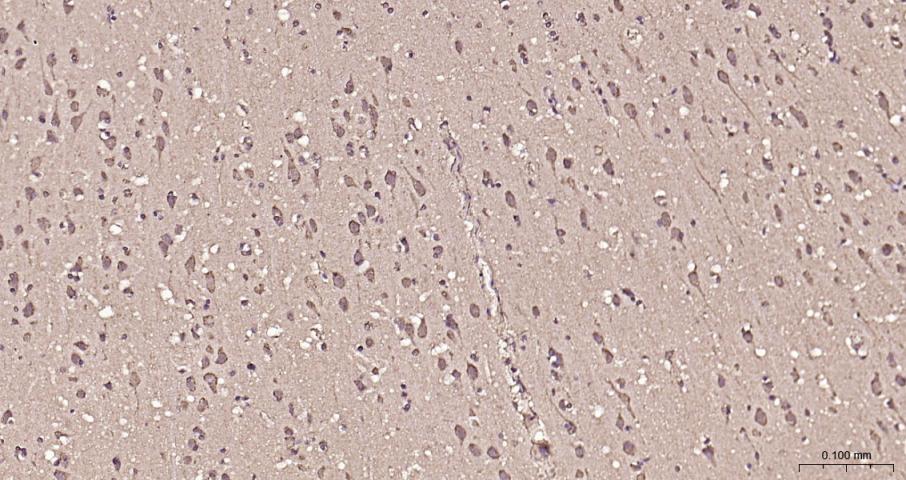 脂肪酸合成酶重组兔单抗
