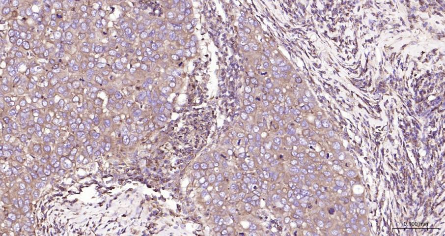 ras癌基因家族Rab5蛋白重组兔单抗-bsm-52451R