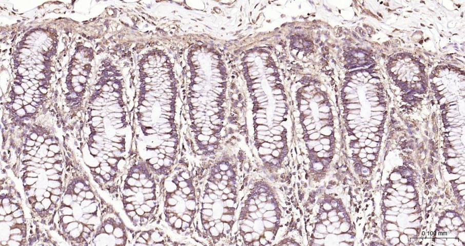ras癌基因家族Rab5蛋白重组兔单抗-bsm-52451R