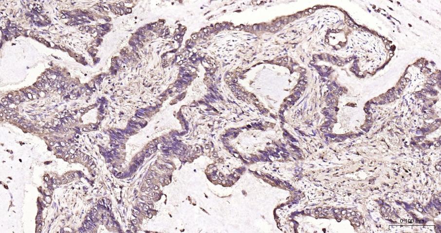 脂肪酸合成酶重组兔单抗