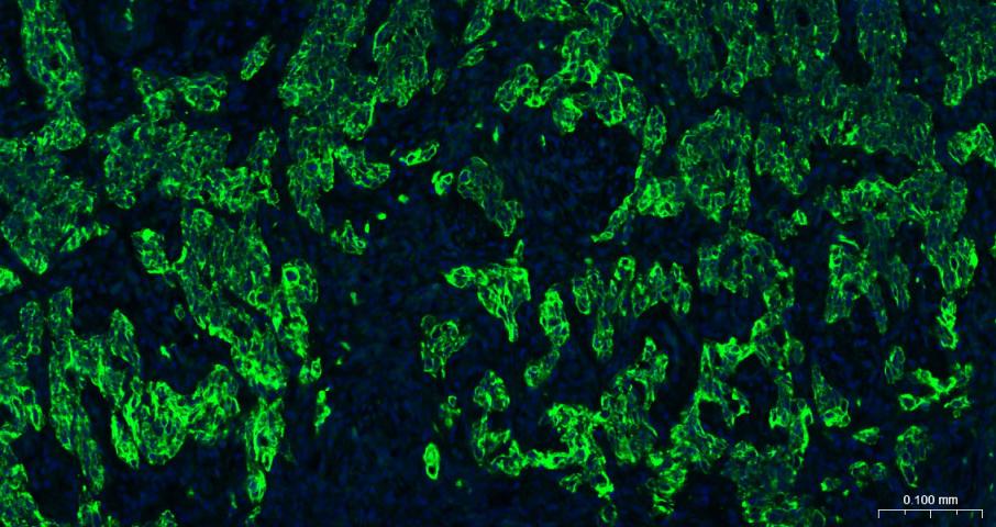细胞角蛋白5重组兔单抗