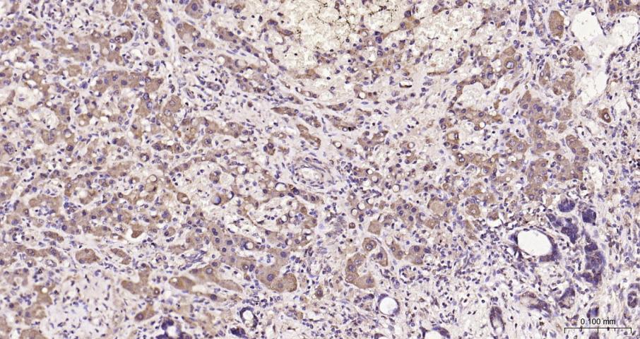 脂肪酸合成酶重组兔单抗