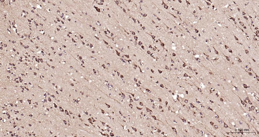 ras癌基因家族Rab5蛋白重组兔单抗-bsm-52451R