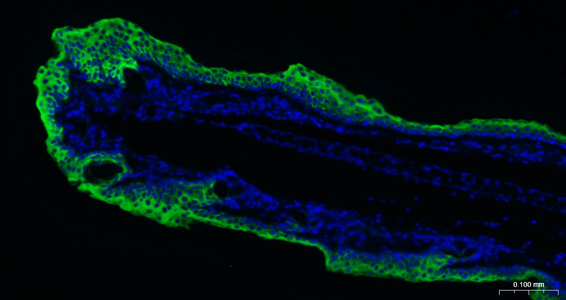 细胞角蛋白10重组兔单抗
