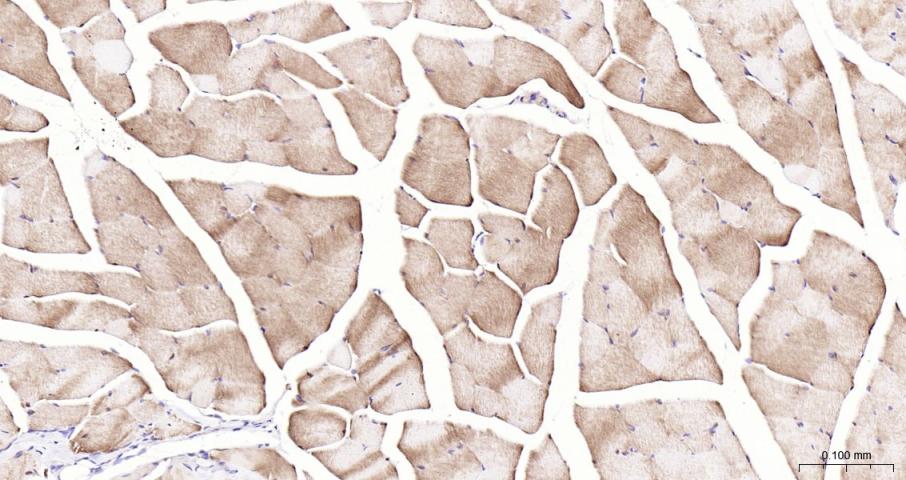 乳酸脱氢酶重组兔单抗