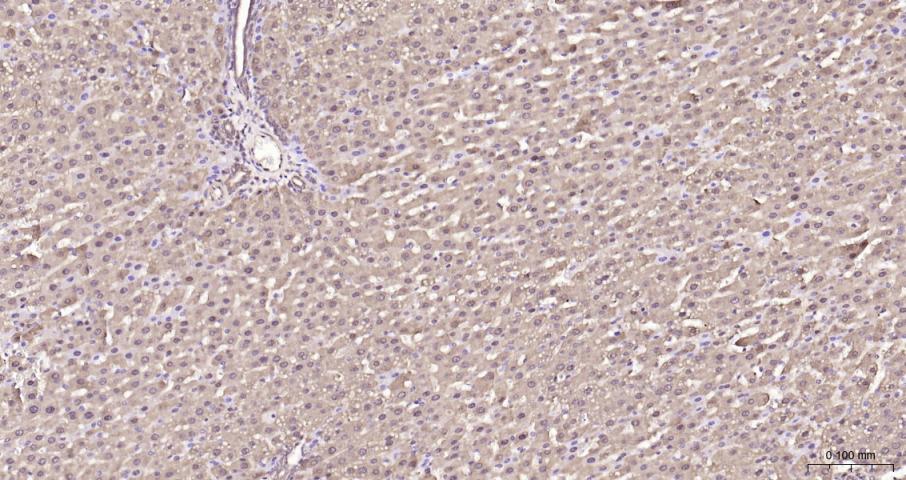 乳酸脱氢酶重组兔单抗