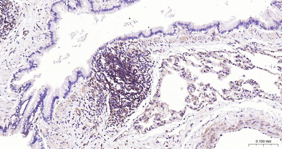 细胞核因子/k基因结合核因子重组兔单抗