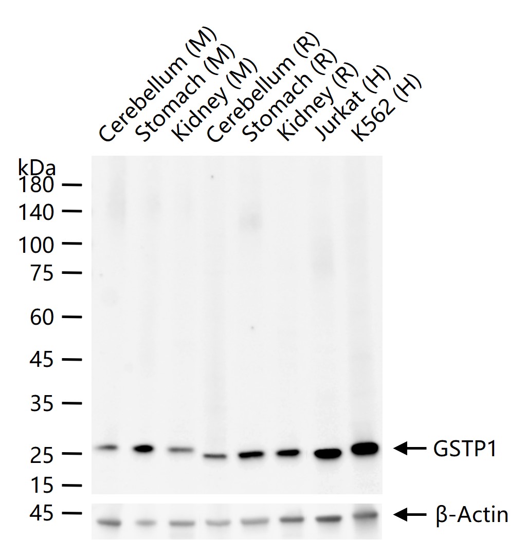 谷胱甘肽硫转移酶pi重组兔单抗