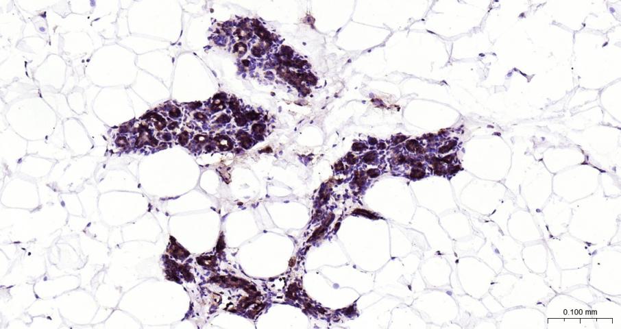 细胞核因子/k基因结合核因子重组兔单抗