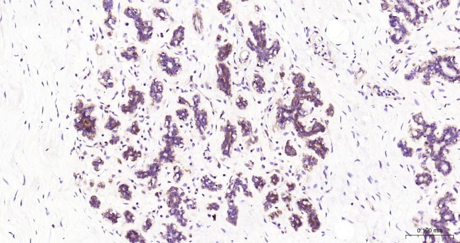 细胞核因子/k基因结合核因子重组兔单抗
