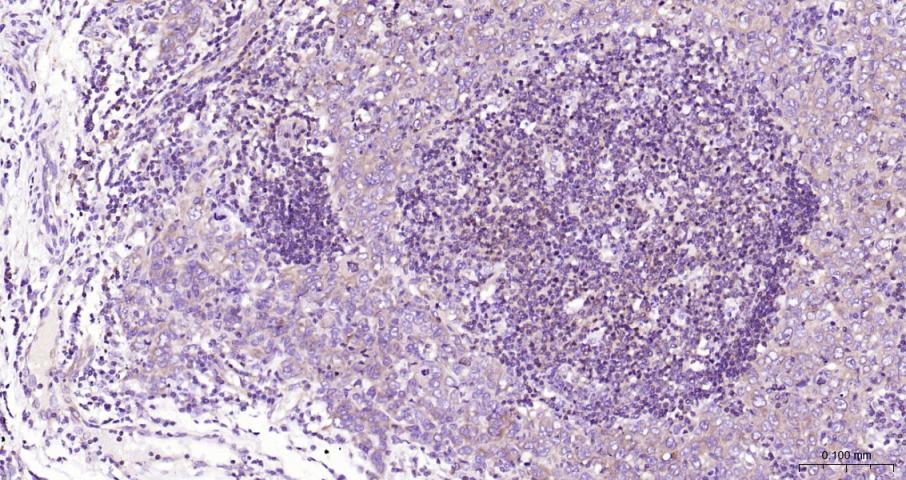 细胞核因子/k基因结合核因子重组兔单抗