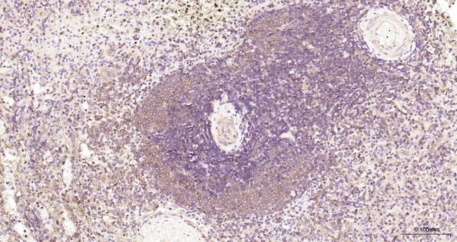 细胞核因子/k基因结合核因子重组兔单抗