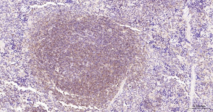 细胞核因子/k基因结合核因子重组兔单抗