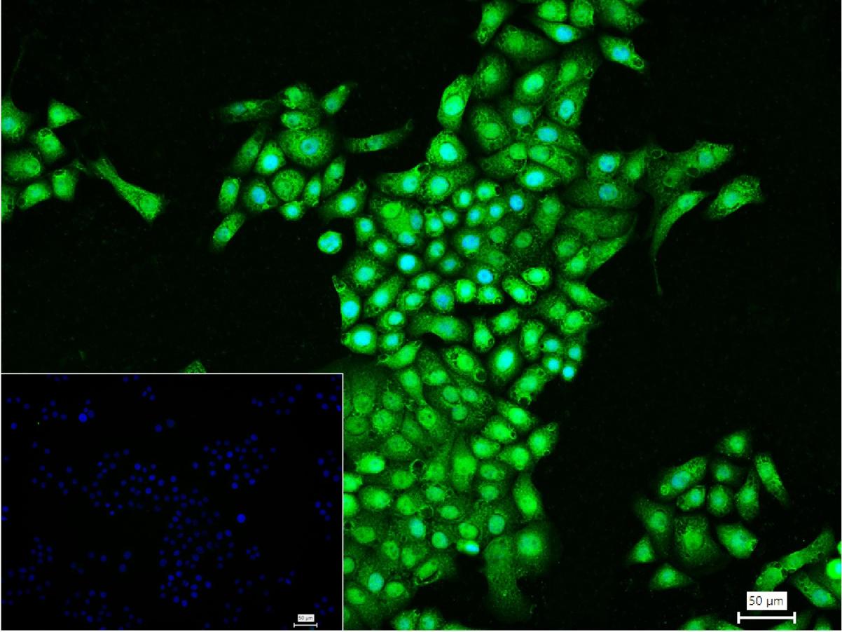 组蛋白赖氨酸特异性脱甲基酶1重组兔单抗