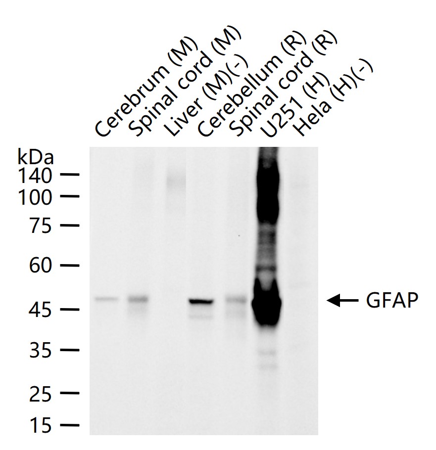 胶质纤维酸性蛋白重组兔单抗