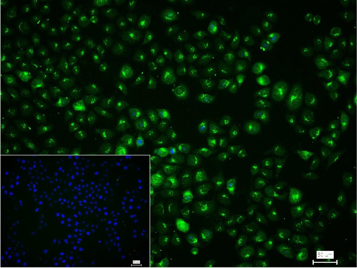 周期素B1重组兔单抗