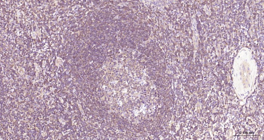 细胞核因子/k基因结合核因子重组兔单抗