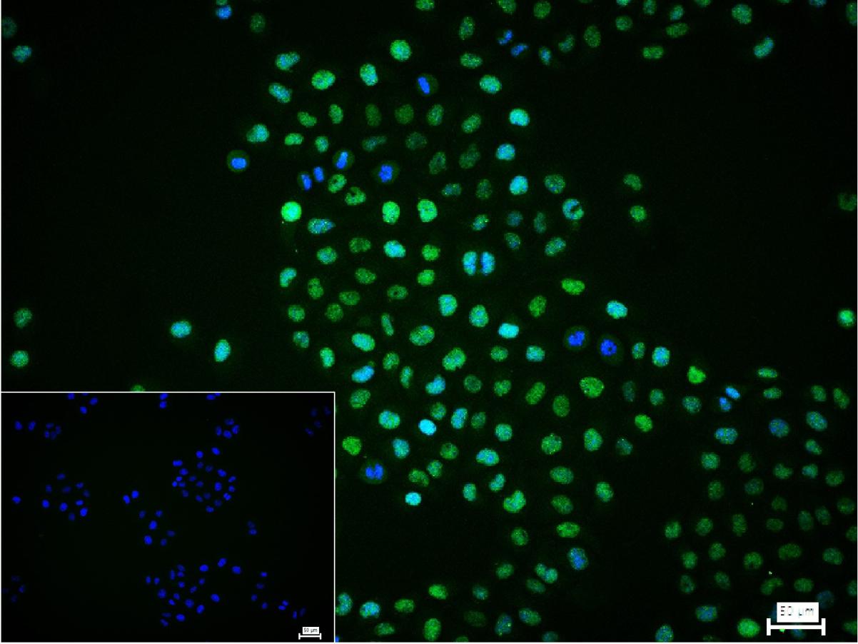 缺氧诱导因子1α /HIF-1α重组兔单抗