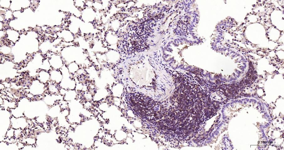 细胞核因子/k基因结合核因子重组兔单抗