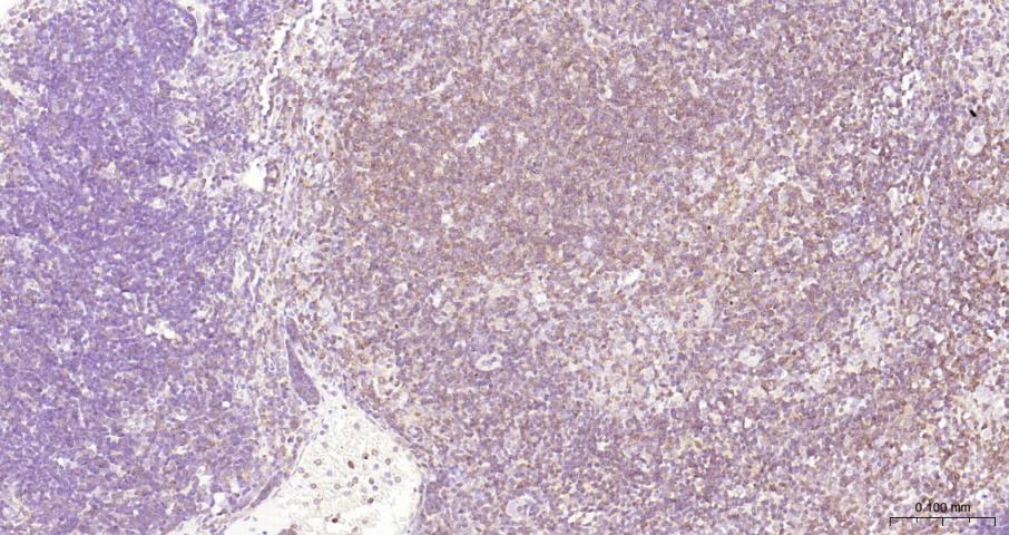 细胞核因子/k基因结合核因子重组兔单抗