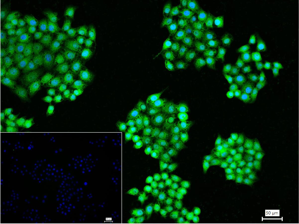 超氧化物歧化酶1重组兔单抗