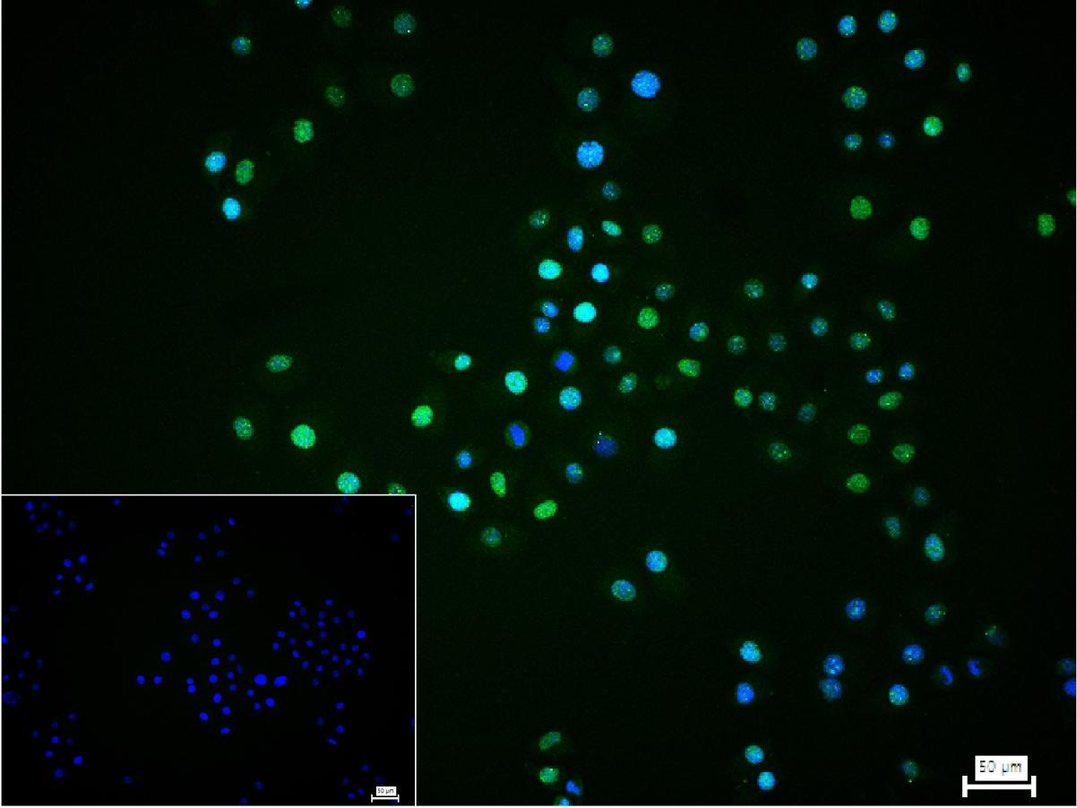 缺氧诱导因子1α /HIF-1α重组兔单抗