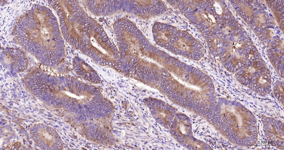细胞核因子/k基因结合核因子重组兔单抗