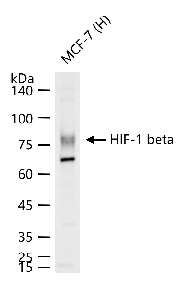 缺氧诱导因子1β/HIF-1β重组兔单抗