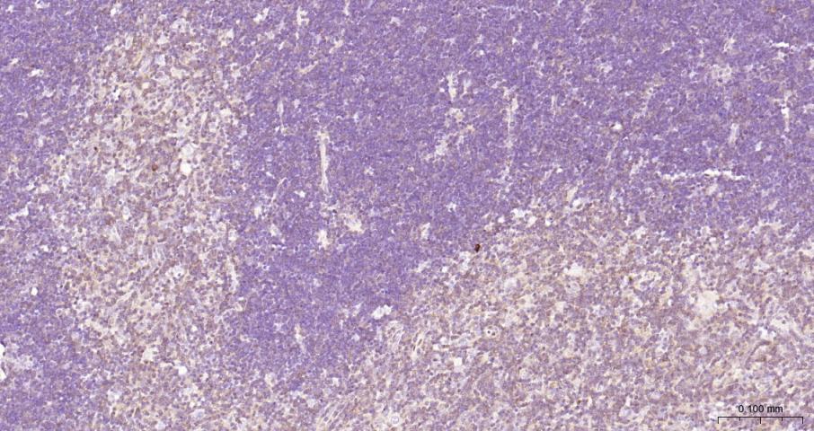 细胞核因子/k基因结合核因子重组兔单抗