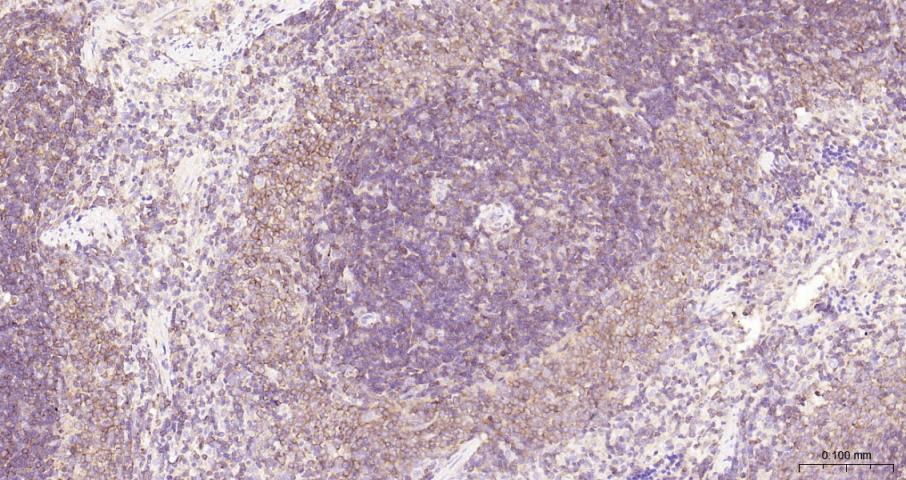 细胞核因子/k基因结合核因子重组兔单抗