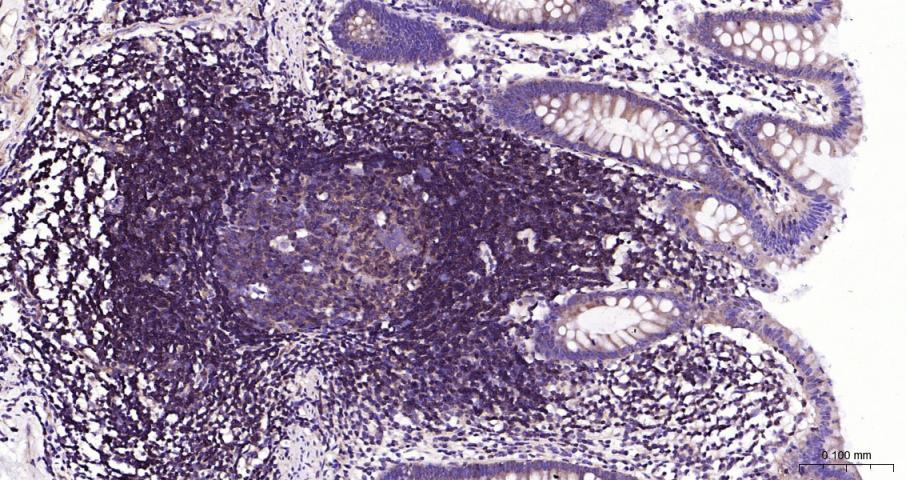 细胞核因子/k基因结合核因子重组兔单抗
