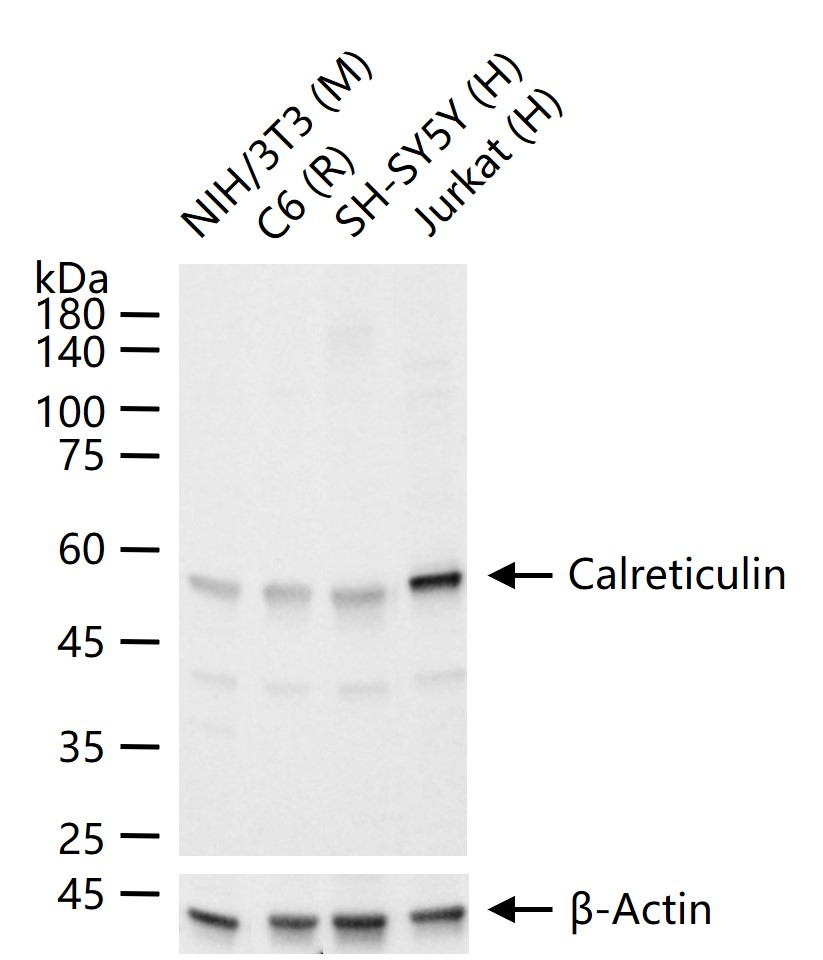 Calreticulin Rabbit pAb (一抗) - WB | Bioss
