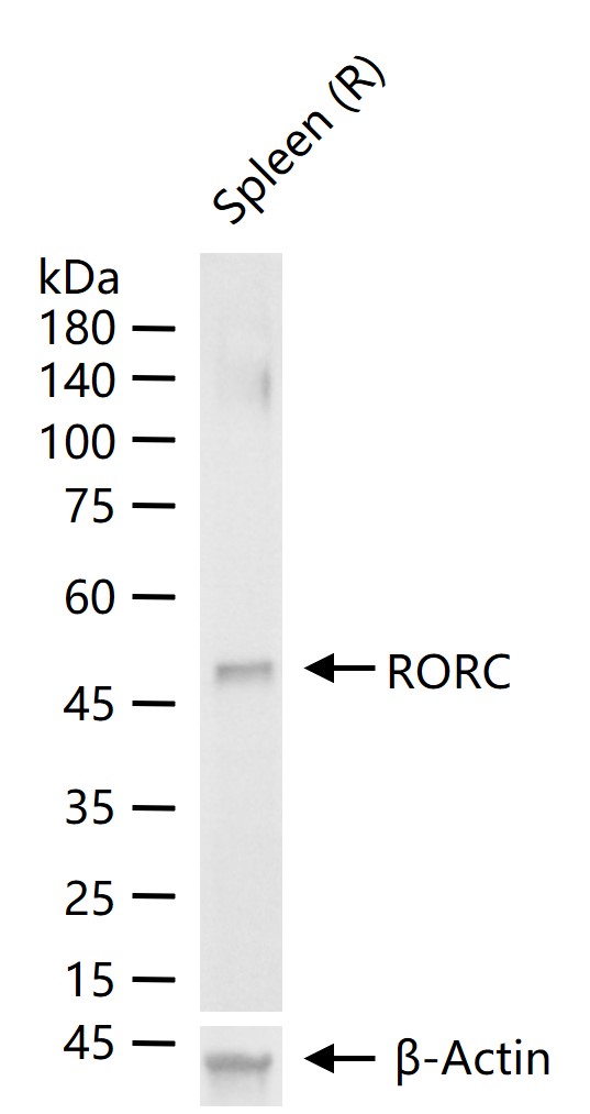 RORC Rabbit pAb (一抗) - WB,IHC-P,IHC-F,IF,Flow-Cyt | Bioss