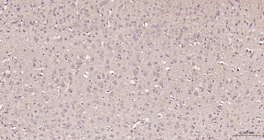 脂肪酸合成酶重组兔单抗