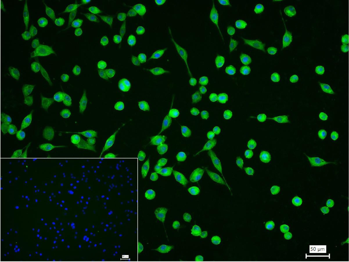 钙蛋白酶1重组兔单抗