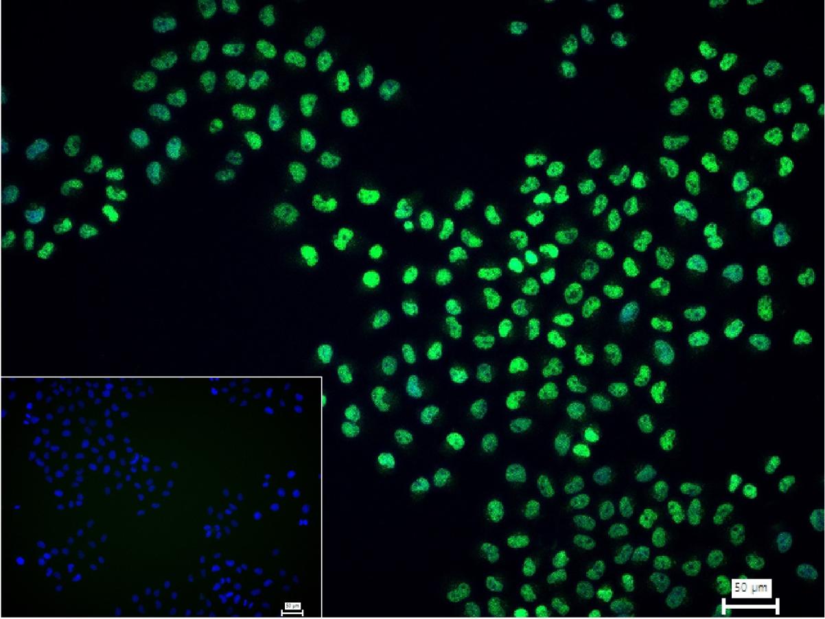 异染色质蛋白1-γ/HP-1γ重组兔单抗-bsm-61603R