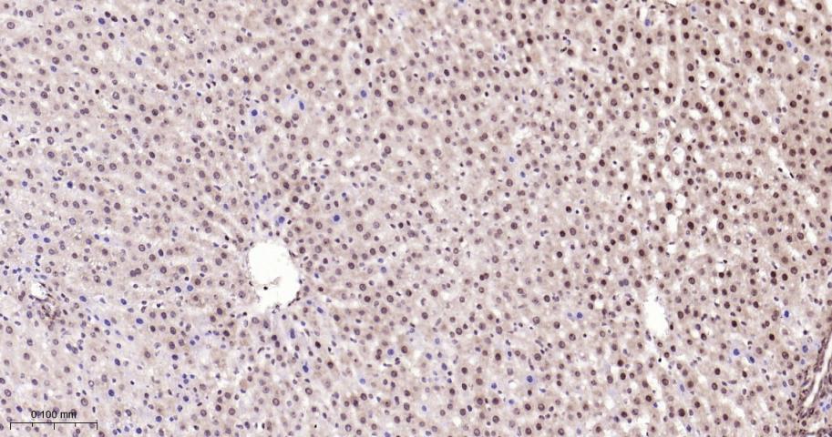 细胞核转录因子X盒结合蛋白重组兔单抗