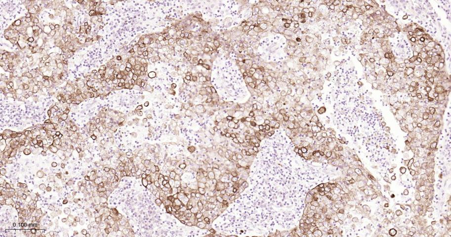 细胞角蛋白18重组兔单抗