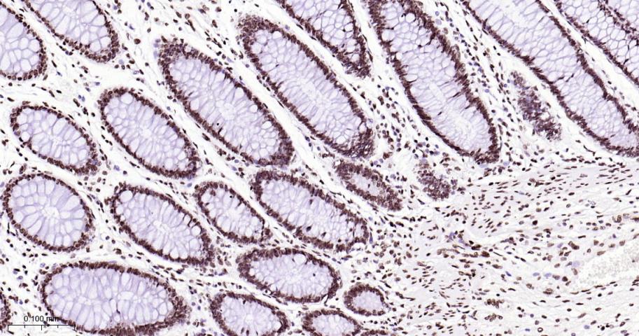 热休克因子1重组兔单抗