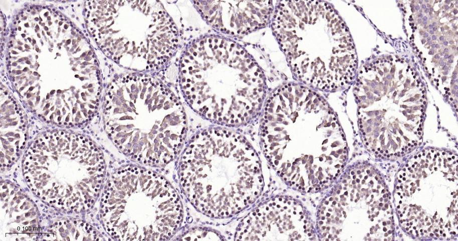 核有丝分裂器NuMA蛋白重组兔单抗