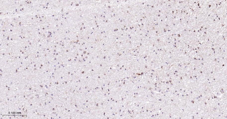 信号转导和转录激活因子6重组兔单抗