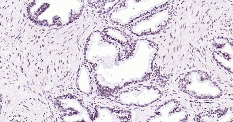 热休克因子1重组兔单抗