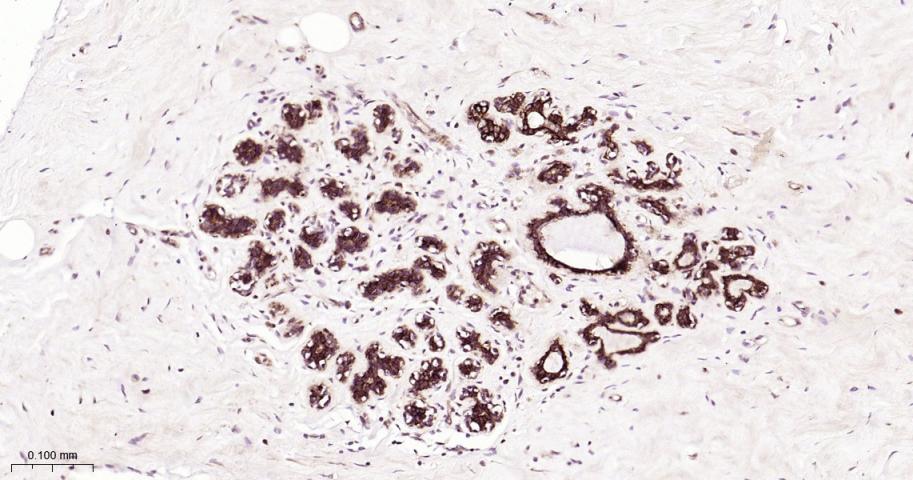 细胞角蛋白18重组兔单抗