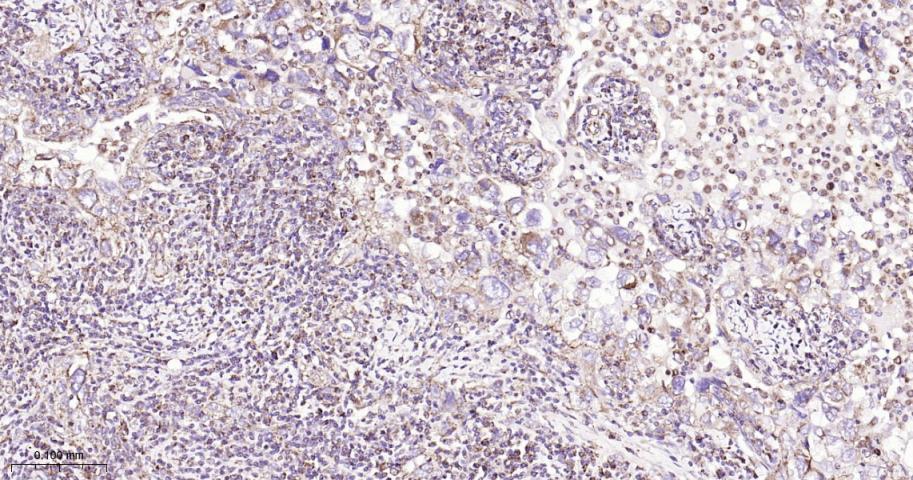信号转导和转录激活因子6重组兔单抗