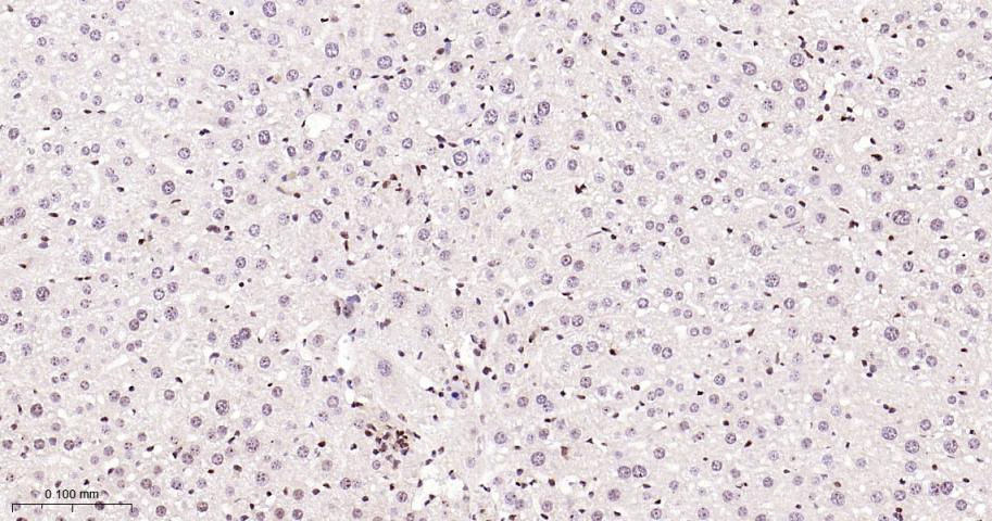 细胞核转录因子X盒结合蛋白重组兔单抗