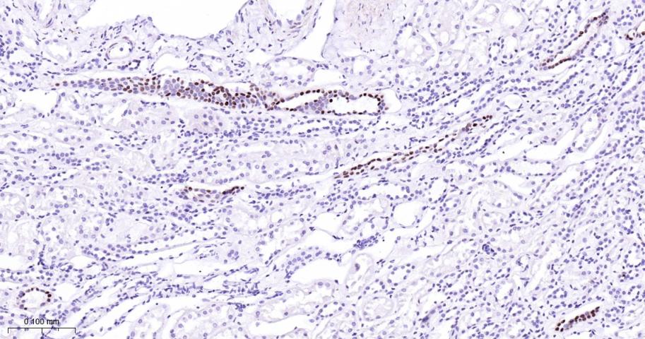 GATA结合蛋白3重组兔单克隆抗体
