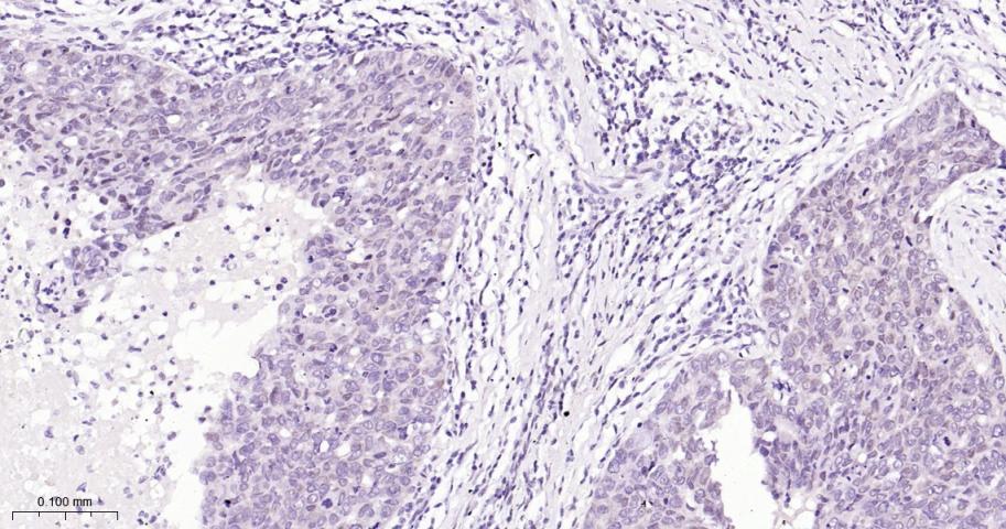 缺氧诱导因子1β/HIF-1β重组兔单抗